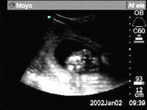 A sonogram of one of our baby elephants